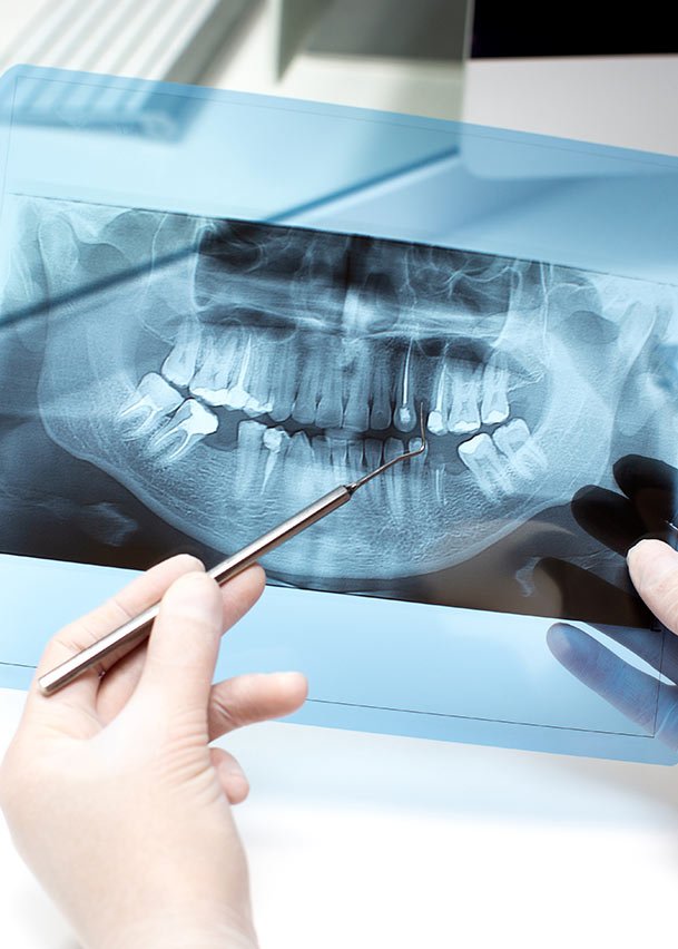 Prótesis Dentales Fijas y Flexibles en Bogotá