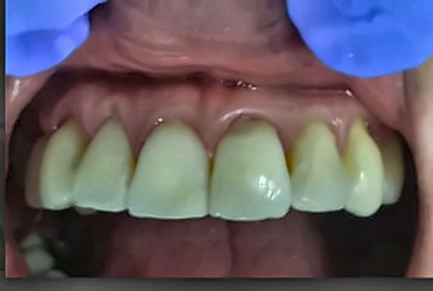 Transformación de Color y Forma Antes