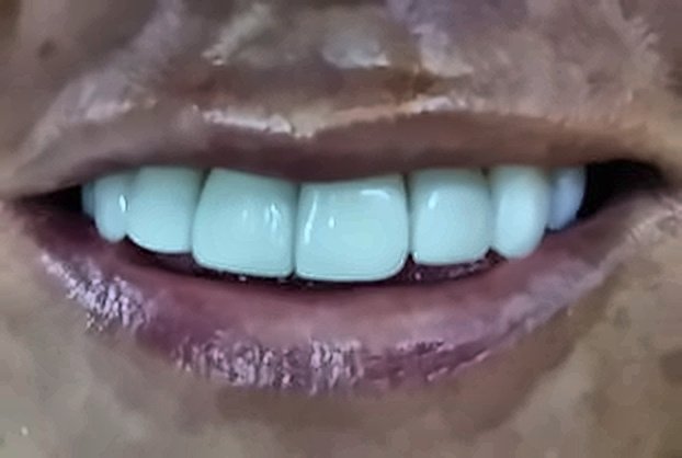 Transformación de Color y Forma Después