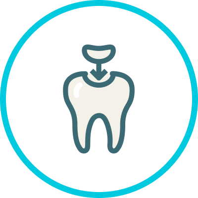 Implantes Dentales