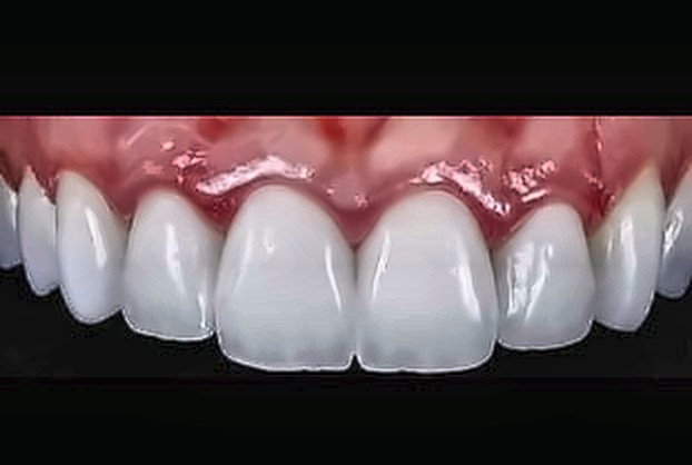 Rehabilitación Funcional y Estética Después